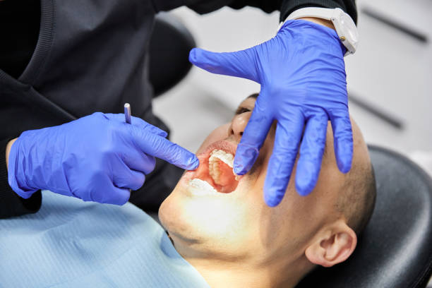 Best Emergency Tooth Extraction in Cortland, IL